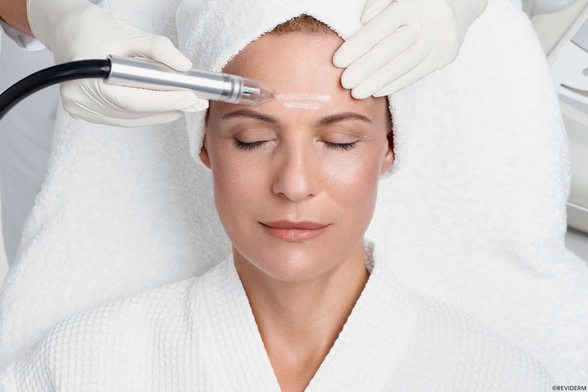 mikrodermabrasion